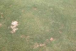 フェアリーリング病